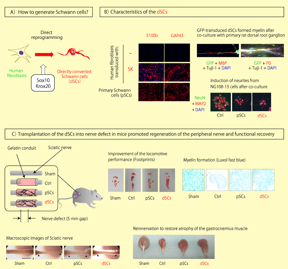 シュワン細胞のダイレクト・リプログラミングと末梢神経損傷の再生